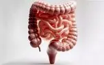 یک ترکیب ضدالتهابی قوی برای سلامت روده