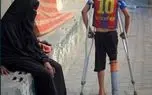 تصاویر؛ لوله پلاستیکی جای پای قطع شده کودک فلسطینی را گرفت