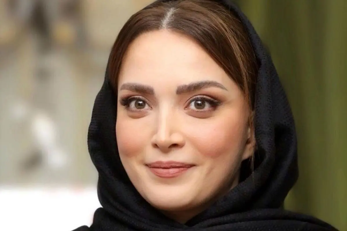 فیلم زیرزمینی بهنوش طباطبایی قبل از عمل زیبایی