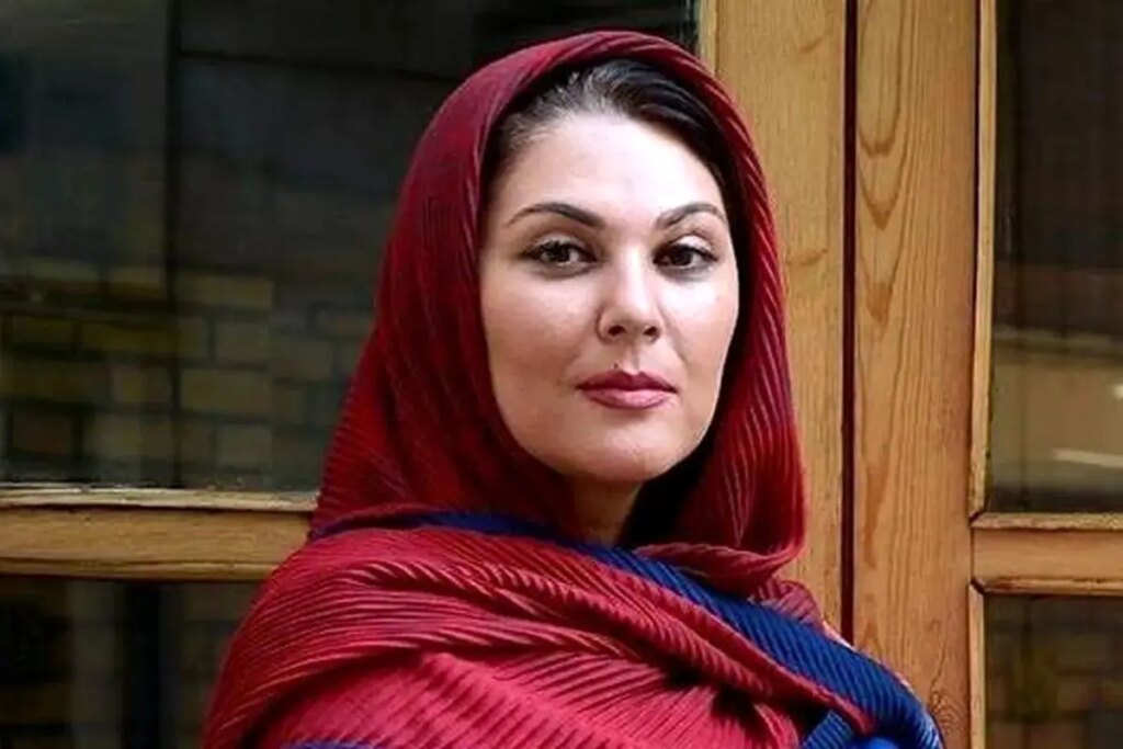 تغییر چهره لاله اسکندری پس از جراحی زیبایی/فیلم