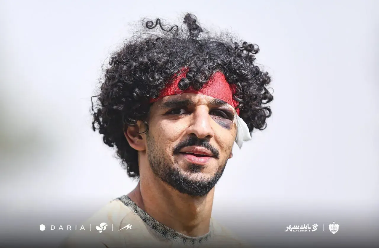 تصویر شوکه‌کننده از چشم بازیکن پرسپولیس