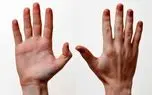 چرا انگشتان دست انسان این‌گونه شکل گرفته‌اند؟