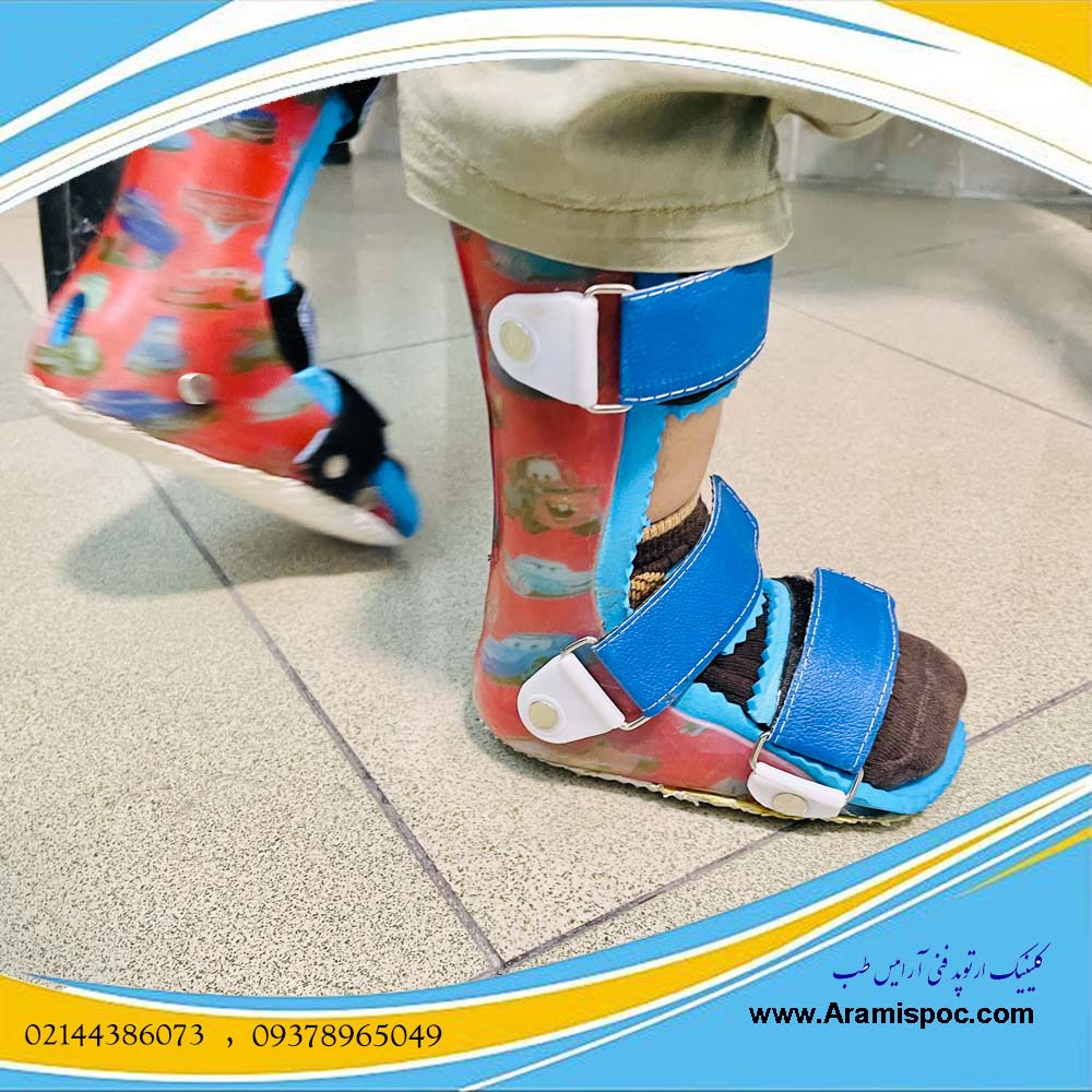 درمان بریس یا ارتوز غرب تهران